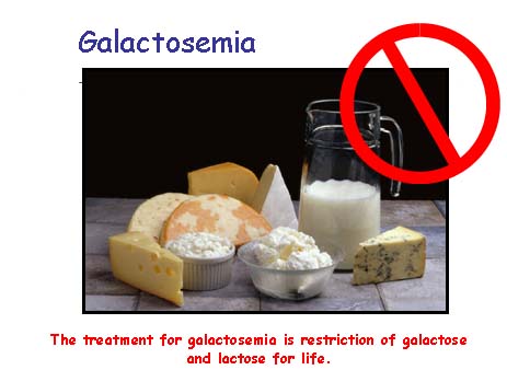 galactose foods